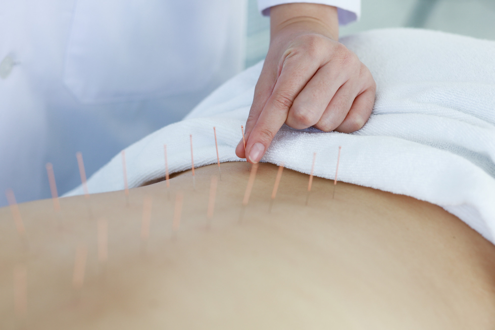 Acupuncture for Mental Health Disorders